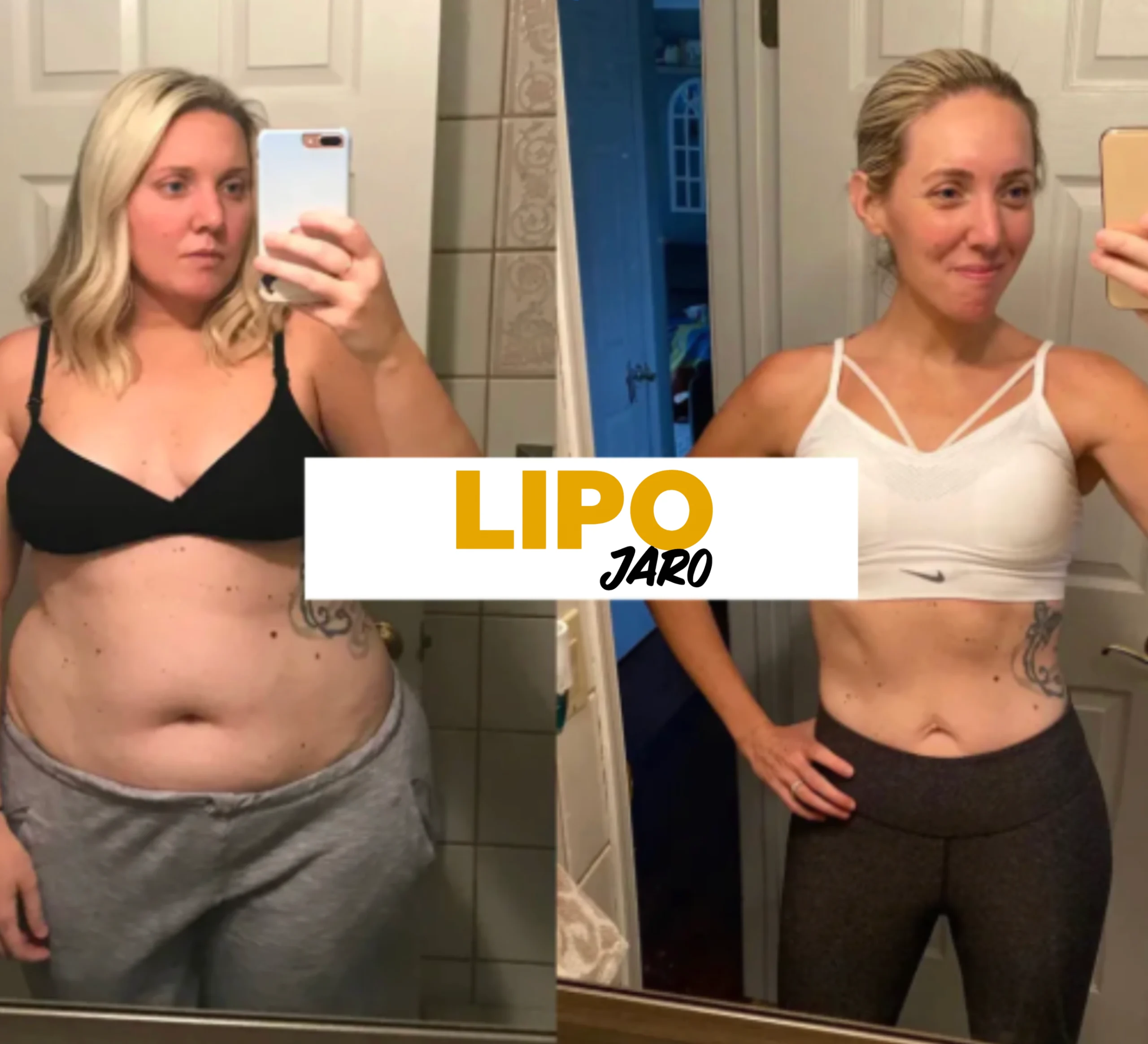 LipoJaro Forte Kapseln